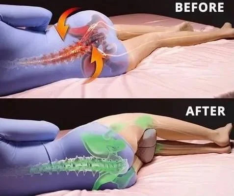 ARORA Premium Sciatica Relief Pillow- Support for Back and Hips